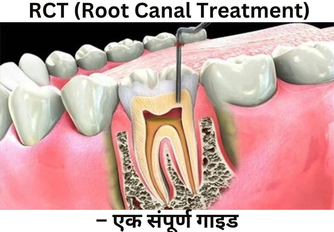 – एक संपूर्ण गाइड RCT